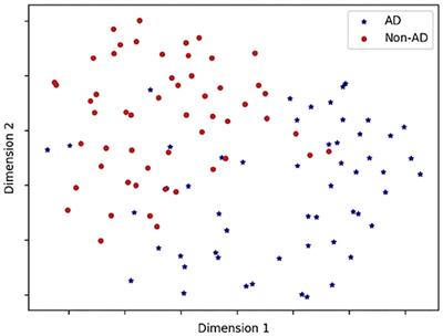 Comparing Pre-trained and Feature-Based Models for Prediction of Alzheimer's Disease Based on Speech